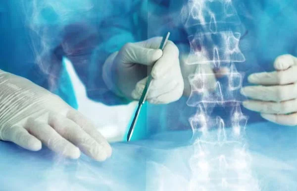 Minimally Invasive Spine Surgery