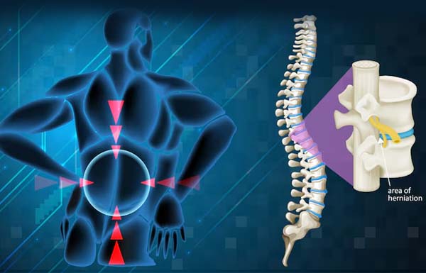 Cervical Thoracic and Lumbar Spine Surgeries