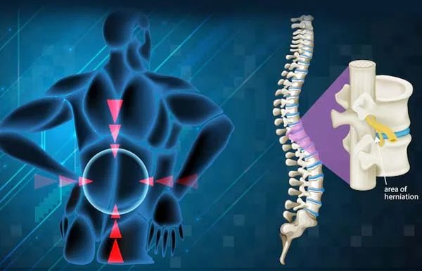 Cervical Thoracic and Lumbar Spine Surgeries