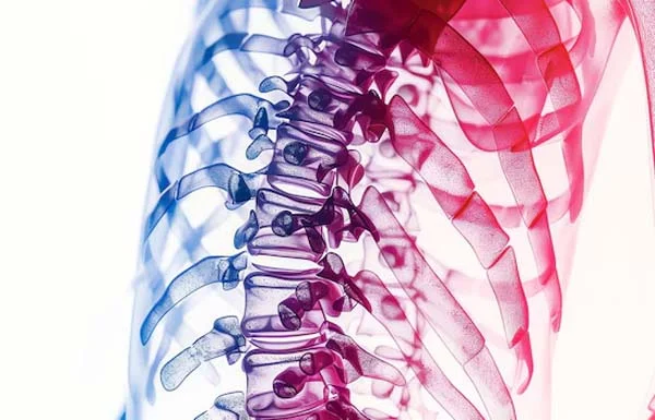 Spinal Fixation and Fusion