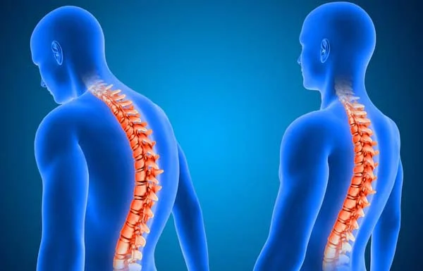 Spinal Infection
