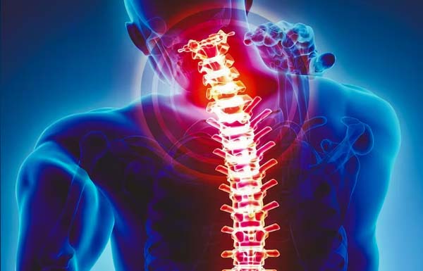 Spondylosis