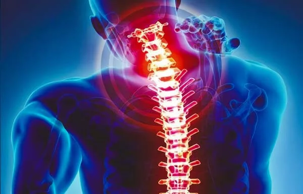 Spondylosis